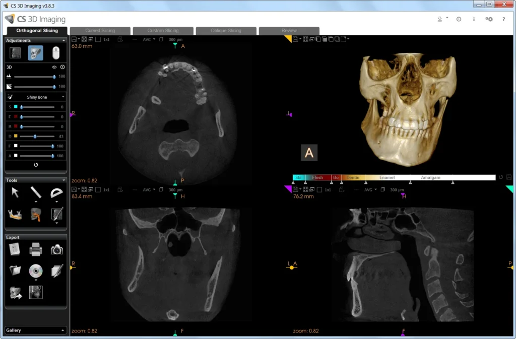 cs3dimaging3.8 custom rendering